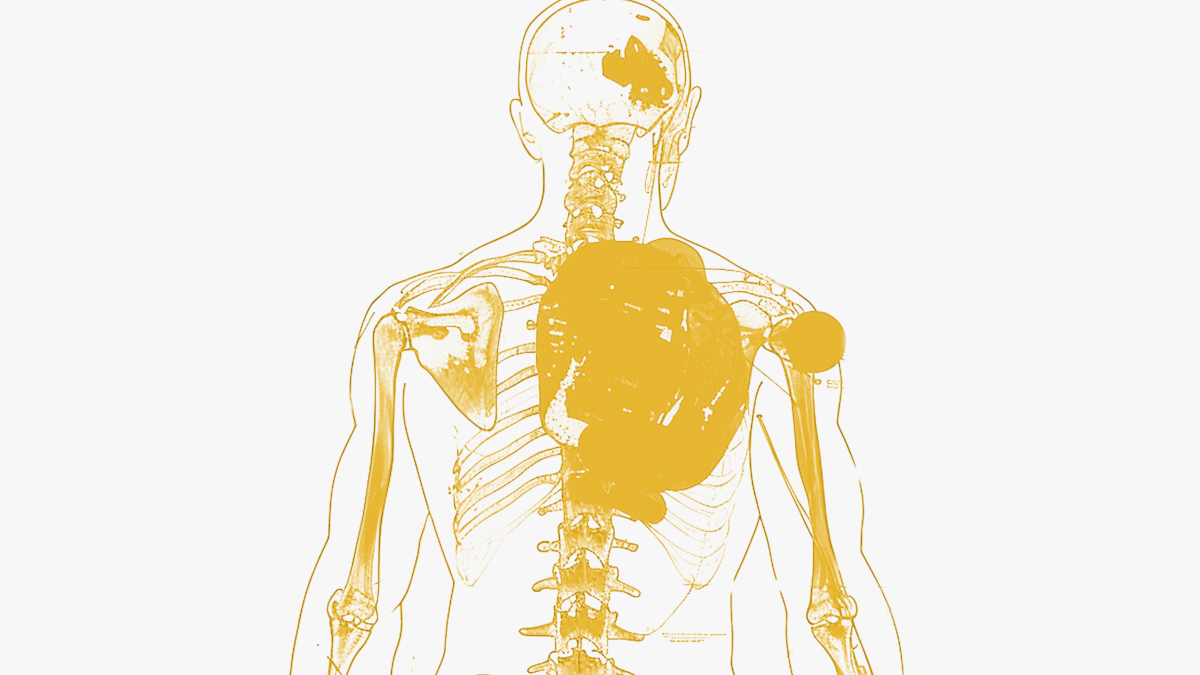 Individu qui souffre d'inflammation chronique